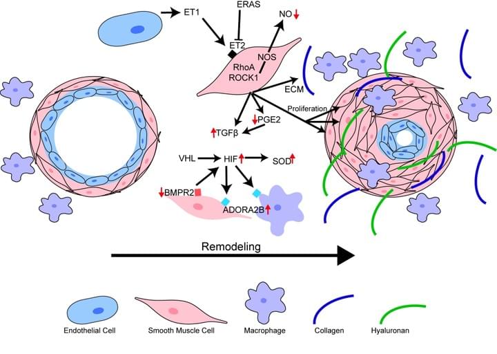 Mechanisms of Group III PH
