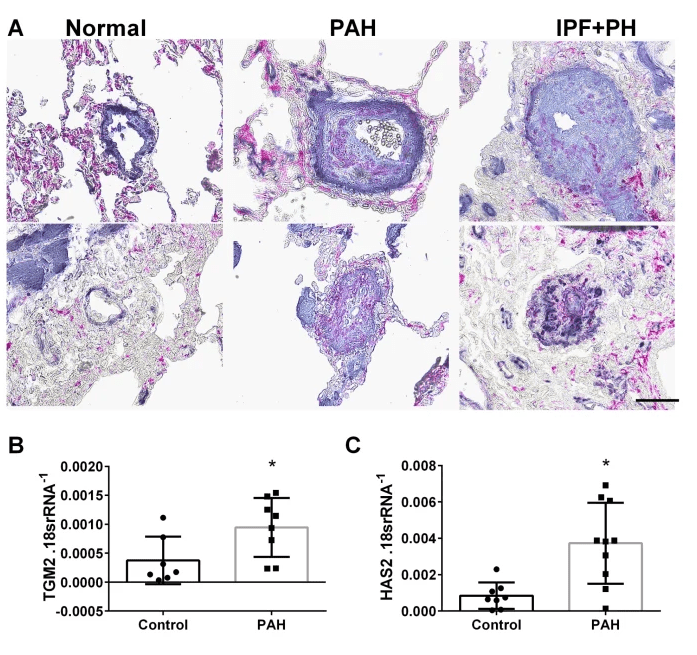 lung IHC for  TGM2 and SMA (panel A) and expression levels of tgm2 and Has2