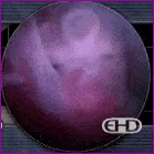 Preborn human with possibly undetectable beating heart Preborn human with possibly undetectable beating heart