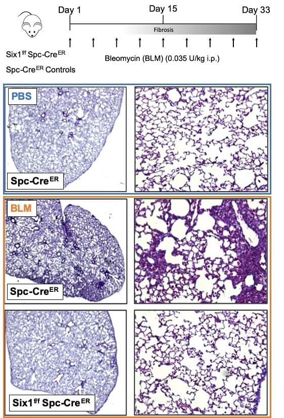 Six1 flox Spc Cre mice have protection against lung fibrosis by histology