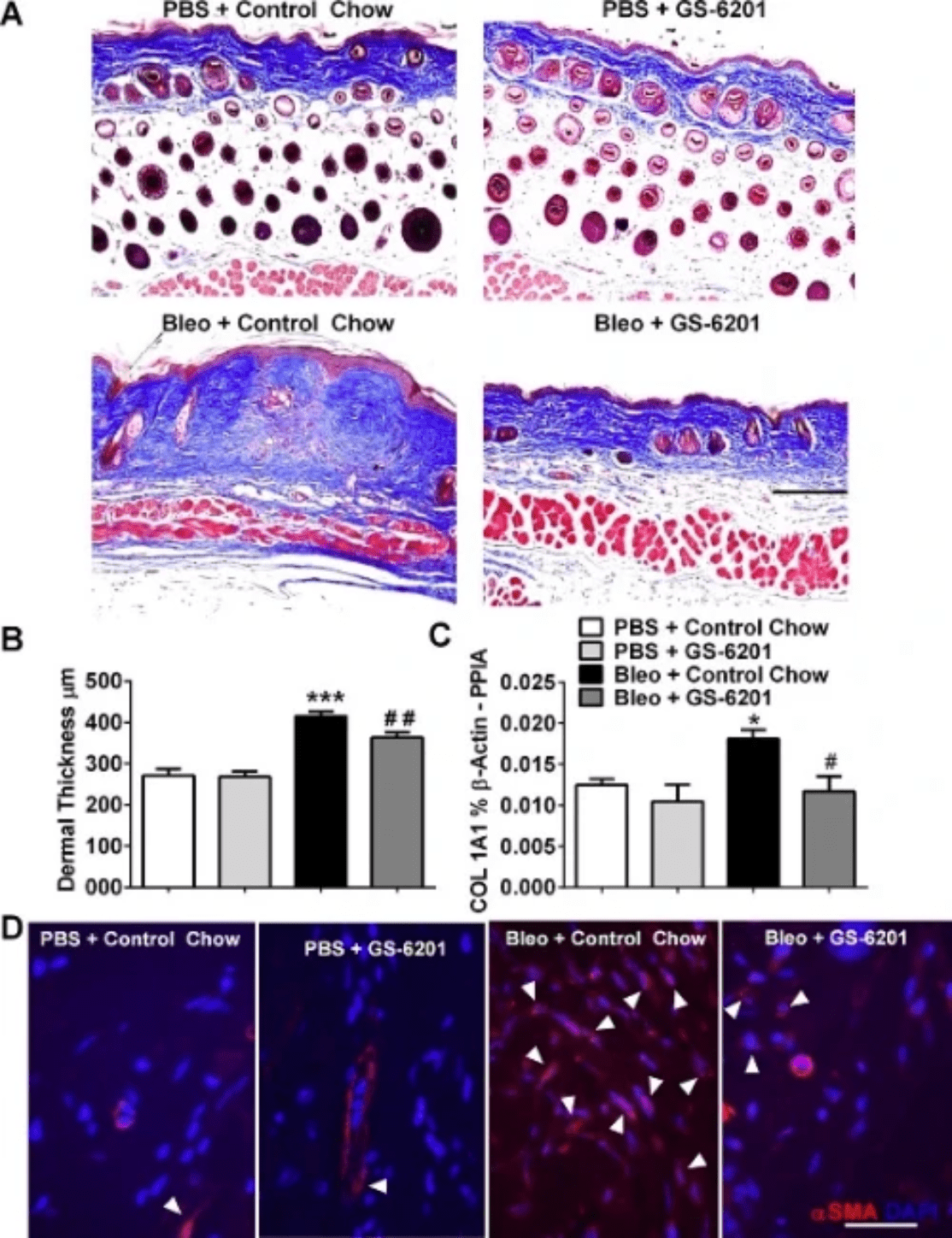 Adenosine signaling in dermal fibrosis