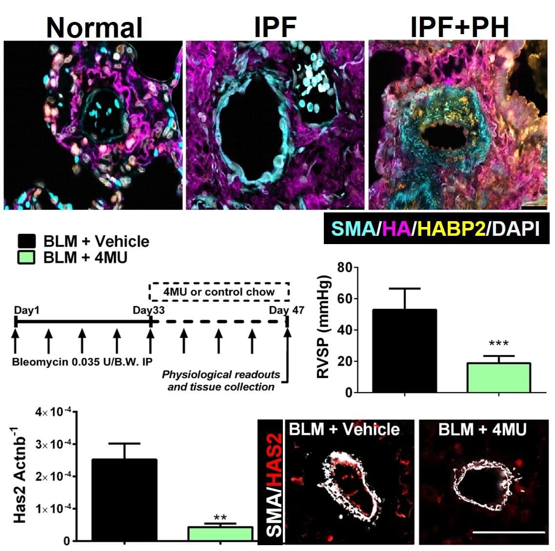 Hyaluornan, IPF and Group III PH 