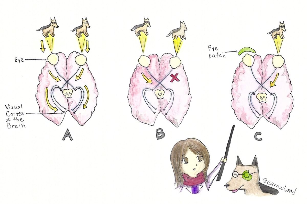amblyopia; visual system; visual pathway; eye; brain; visual cortex; Eye Dogtor Julie; @carmel.md amblyopia; visual system; visual pathway; eye; brain; visual cortex; Eye Dogtor Julie; @carmel.md
