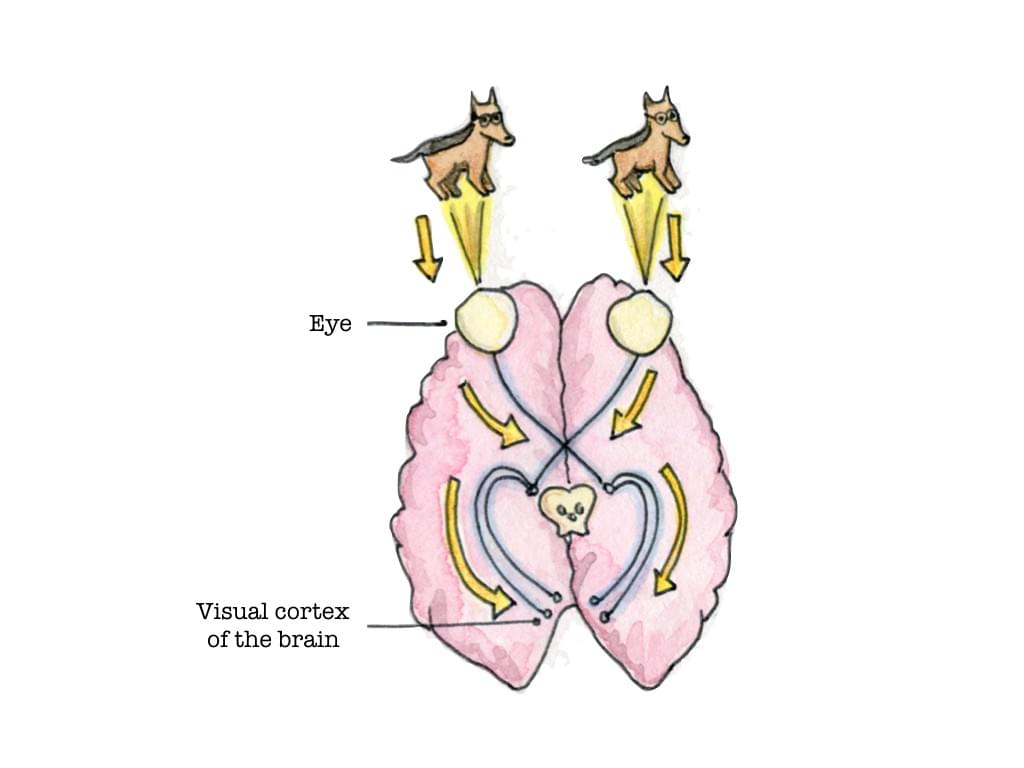 eye anatomy; visual cortex; visual system; Eye Dogtor Julie; carmel.md eye anatomy; visual cortex; visual system; Eye Dogtor Julie; carmel.md