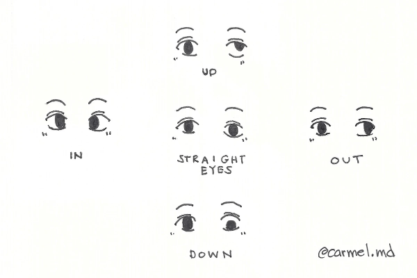 Examples of Strabismus, by @carmel.md . Exotropia, esotropia, hypertropia, hypotropia. Examples of Strabismus, by @carmel.md . Exotropia, esotropia, hypertropia, hypotropia.