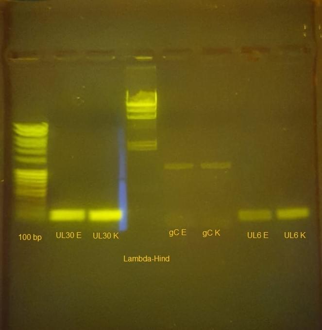 Agarose gel on the transilluminator. You can see following bands: 100 bp ladder, UL30 with primers of another company, UL30 with Kilobaser primers, Lambda-Hind ladder, gC with primers of another company, gC with Kilobaser primers, UL6 with primers of another company, UL6 with Kilobaser primers. Agarose gel on the transilluminator. You can see following bands: 100 bp ladder, UL30 with primers of another company, UL30 with Kilobaser primers, Lambda-Hind ladder, gC with primers of another company, gC with Kilobaser primers, UL6 with primers of another company, UL6 with Kilobaser primers.
