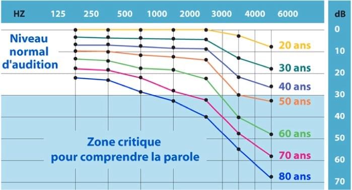 niveaux baisse d'audition / surdité selon age niveaux baisse d'audition / surdité selon age