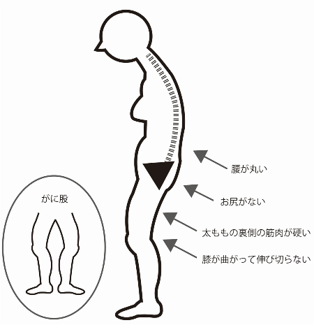 フロントタイプ フロントタイプ
