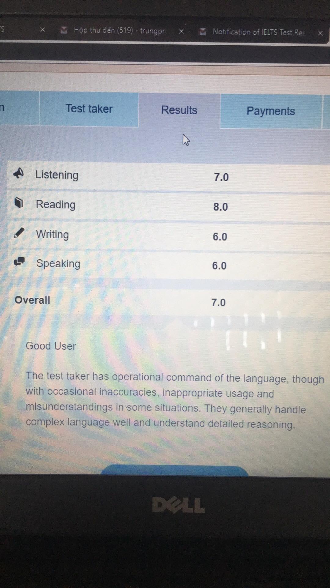 【HƯỚNG DẪN TỪNG BƯỚC】CÁCH LÀM BÀI TẬP MẪU IELTS READING DẠNG FILL IN THE GAP 【HƯỚNG DẪN TỪNG BƯỚC】CÁCH LÀM BÀI TẬP MẪU IELTS READING DẠNG FILL IN THE GAP
