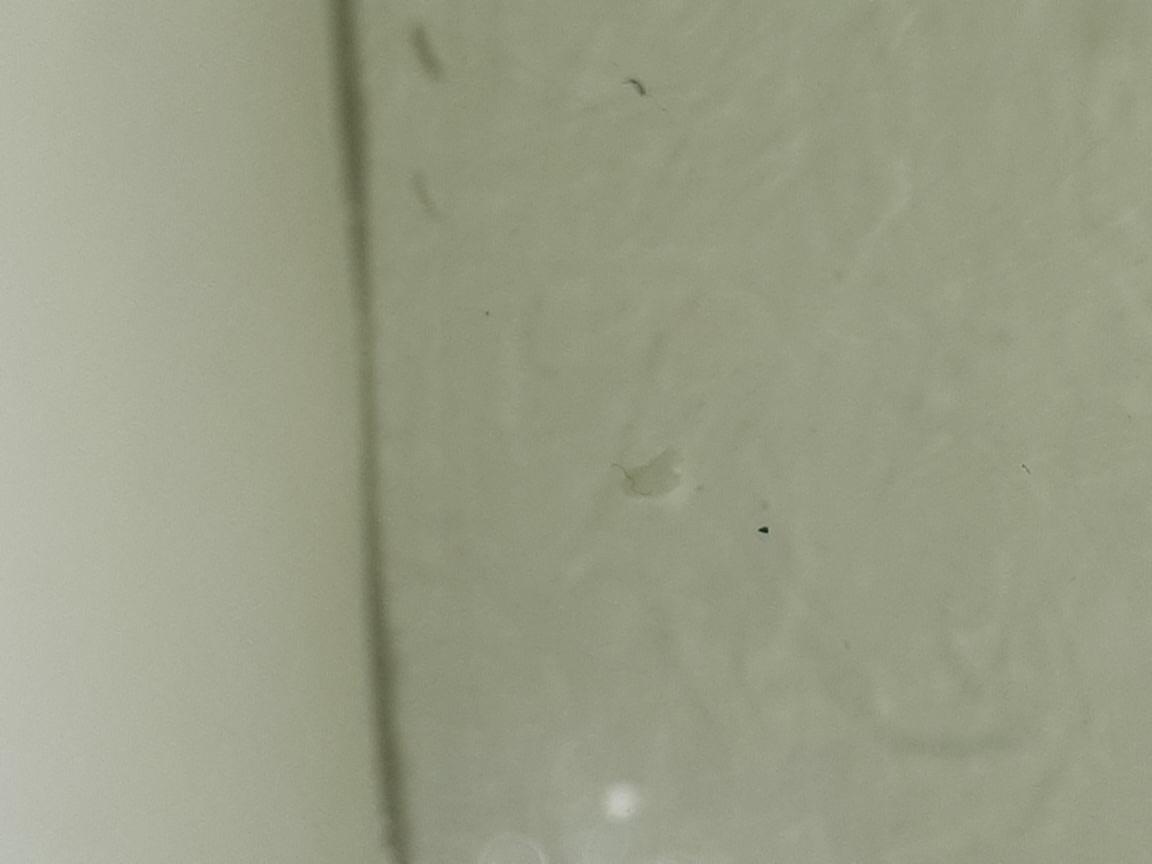 Expelled matter from bladder after subject took praziquantel Expelled matter from bladder after subject took praziquantel