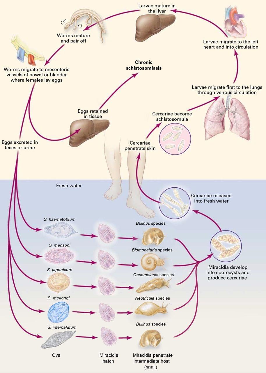 Schistosomiasis after Praziquantel Schistosomiasis after Praziquantel
