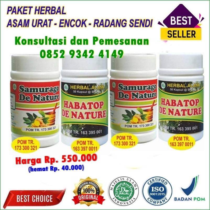 cara menurunkan asam urat dan kolesterol, cara menurunkan asam urat dg cepat, cara mengobati asam urat tradisional, ikan yang boleh dimakan penderita asam urat, sayuran untuk penderita asam urat, pantangan asam urat, makanan untuk penderita asam urat, resep masakan untuk penderita asam urat dan kolesterol, menu makanan bagi penderita asam urat dan kolesterol, daftar makanan pantangan asam urat dan kolesterol, cara menurunkan asam urat dan kolesterol, cara menurunkan asam urat dg cepat, cara mengobati asam urat tradisional, ikan yang boleh dimakan penderita asam urat, sayuran untuk penderita asam urat, pantangan asam urat, makanan untuk penderita asam urat, resep masakan untuk penderita asam urat dan kolesterol, menu makanan bagi penderita asam urat dan kolesterol, daftar makanan pantangan asam urat dan kolesterol,