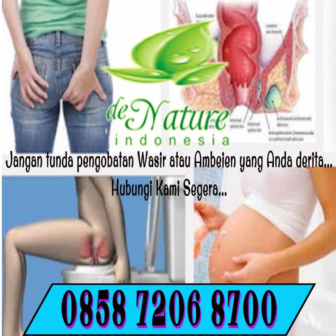 Cara Mengobati Wasir Yg Sudah Keluar Cara Mengobati Wasir Yg Sudah Keluar