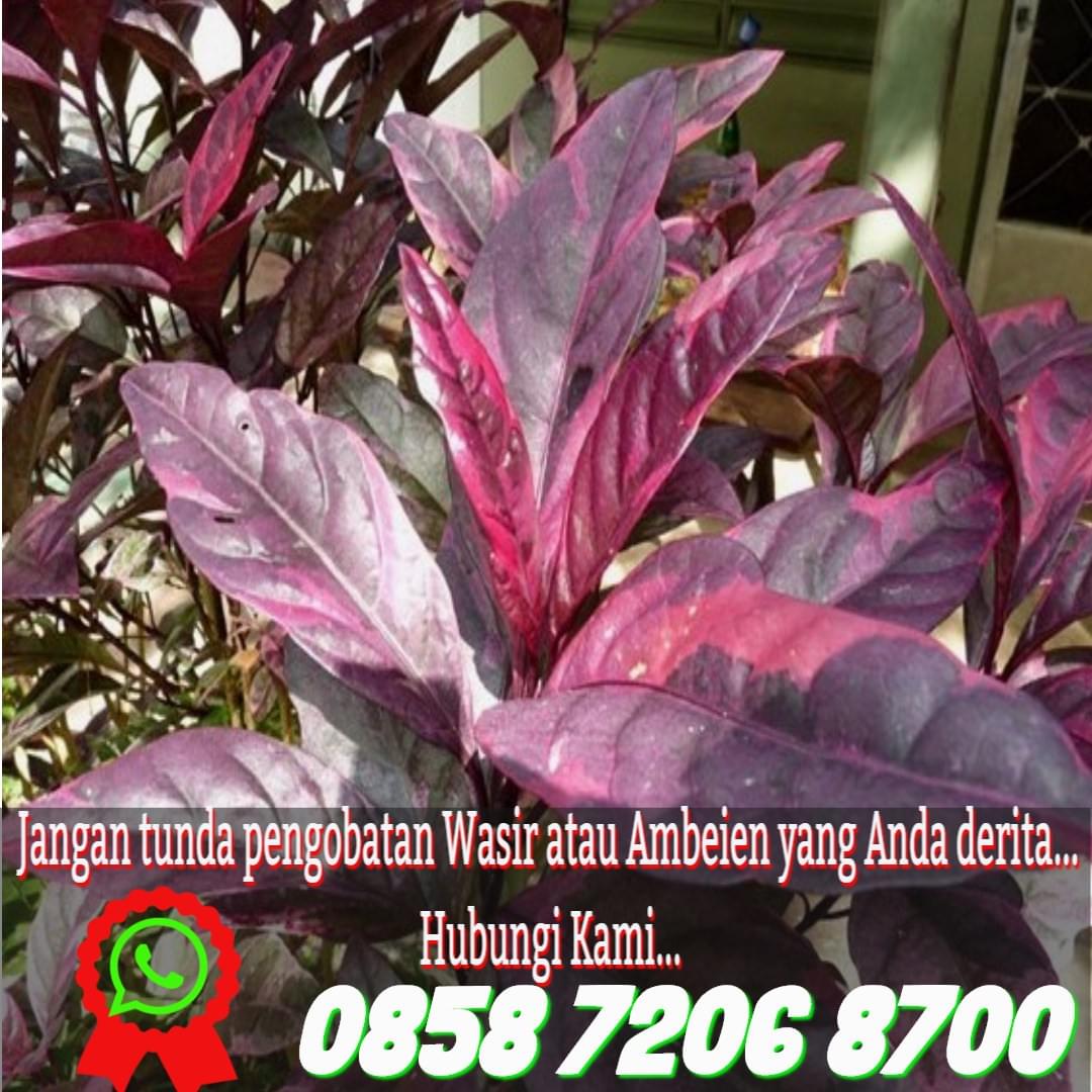 Cara Mengobati Wasir Luar Saat Hamil Cara Mengobati Wasir Luar Saat Hamil