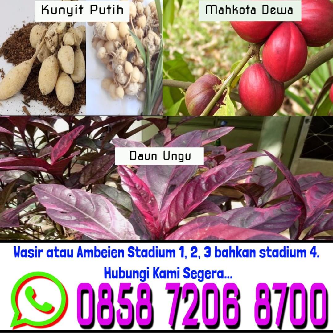 Pengobatan Untuk Wasir Pengobatan Untuk Wasir