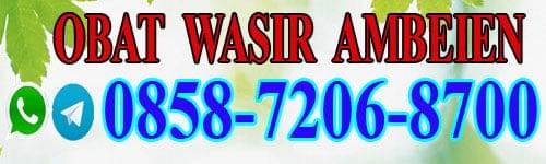 Cara Mengobati Wasir Secara Alami Dan Cepat Cara Mengobati Wasir Secara Alami Dan Cepat