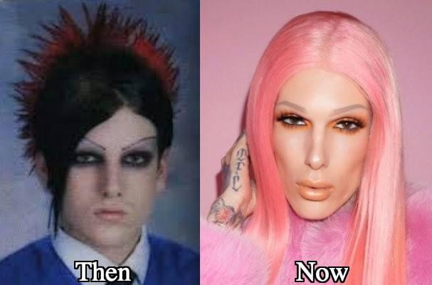 Plastic Surgery On Strikingly