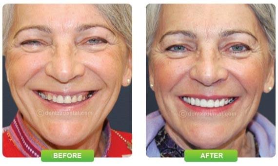 Dentist in Delhi Dentist in Delhi