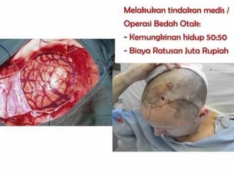 obat stroke herbal obat stroke herbal