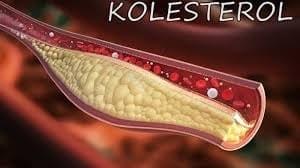 kolestrol kolestrol