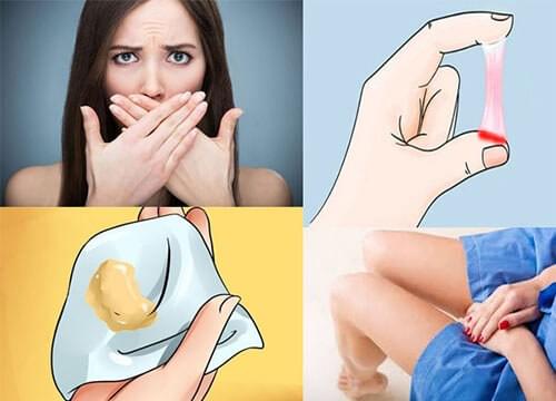 Khi hư khi nào thì là khí hư bất thường Khi hư khi nào thì là khí hư bất thường