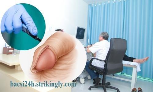 chi phí cắt bao quy đầu tại phòng khám Hưng Thịnh chi phí cắt bao quy đầu tại phòng khám Hưng Thịnh