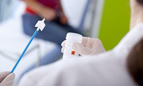xét nghiệm sùi mào gà bằng cách nào xét nghiệm sùi mào gà bằng cách nào