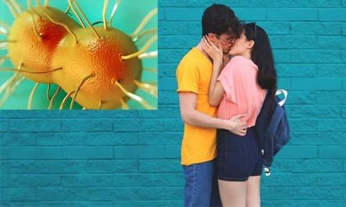 bệnh lậu là gì bệnh lậu là gì
