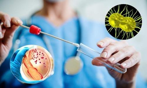 chữa bệnh lậu trong bao lâu chữa bệnh lậu trong bao lâu