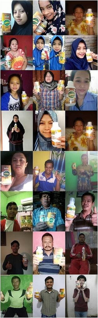Obat Bekas Operasi Caesar Di Apotik, Salep Pengering Luka Operasi 100% Ampuh Obat Bekas Operasi Caesar Di Apotik, Salep Pengering Luka Operasi 100% Ampuh