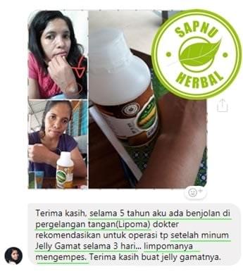 Obat Sekelan Di Apotik / Apotek 100% Alami Jeung Ampuh Tanpa Operasi Obat Sekelan Di Apotik / Apotek 100% Alami Jeung Ampuh Tanpa Operasi