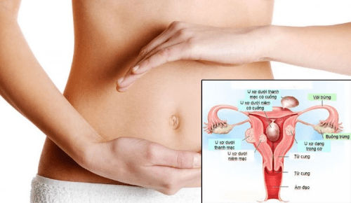 Dấu hiệu viêm nhiễm vùng kín ở nữ Dấu hiệu viêm nhiễm vùng kín ở nữ