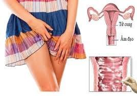 Bệnh phụ khoa ngứa vùng kín là bị gì Bệnh phụ khoa ngứa vùng kín là bị gì