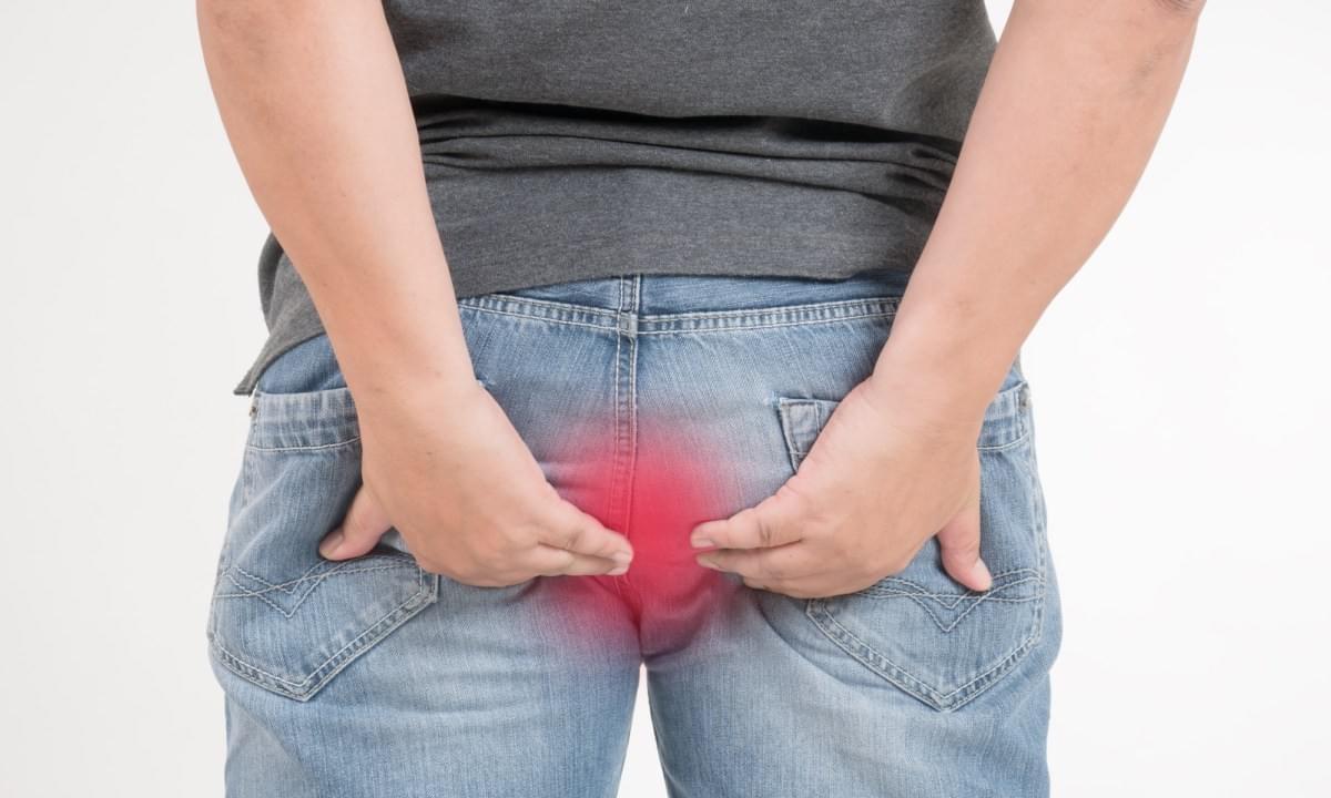 Cắt thịt thừa ở hậu môn như thế nào Cắt thịt thừa ở hậu môn như thế nào