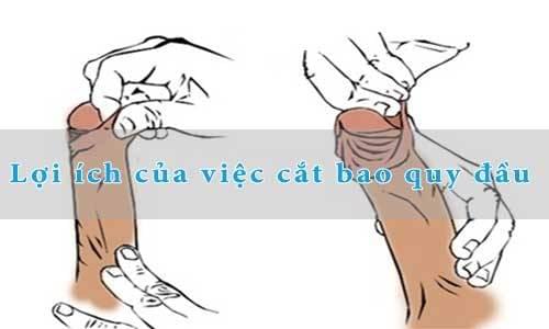 lợi ích của cắt bao quy đầu lợi ích của cắt bao quy đầu