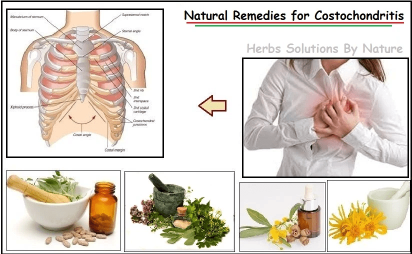 Natural Ways to Heal Costochondritis with Natural Remedies