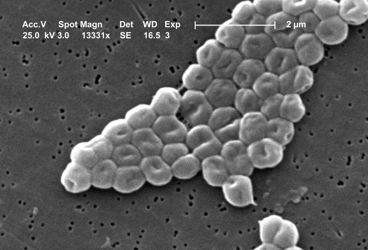Acinetobacter baumannii est une bactérie à Gram-négatif du genre Acinetobacter. Il s'agit d'un germe d'infection opportuniste chez l'Homme, particulièrement chez les personnes immuno-déprimées et que l'on trouve aussi comme agent de maladies nosocomiales où sa transmission est manuportée. Acinetobacter baumannii — Wikipédia Acinetobacter baumannii est une bactérie à Gram-négatif du genre Acinetobacter. Il s'agit d'un germe d'infection opportuniste chez l'Homme, particulièrement chez les personnes immuno-déprimées et que l'on trouve aussi comme agent de maladies nosocomiales où sa transmission est manuportée. Acinetobacter baumannii — Wikipédia