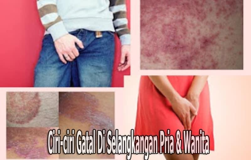 Cara Mengobati Gatal Gatal Pada Anak Secara Tradisional ...