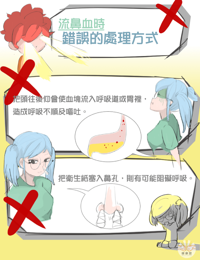 流鼻血應該怎麼辦?常見的錯誤處理方式,除了頭往後仰還有將衛生紙塞進鼻孔 流鼻血應該怎麼辦?常見的錯誤處理方式,除了頭往後仰還有將衛生紙塞進鼻孔
