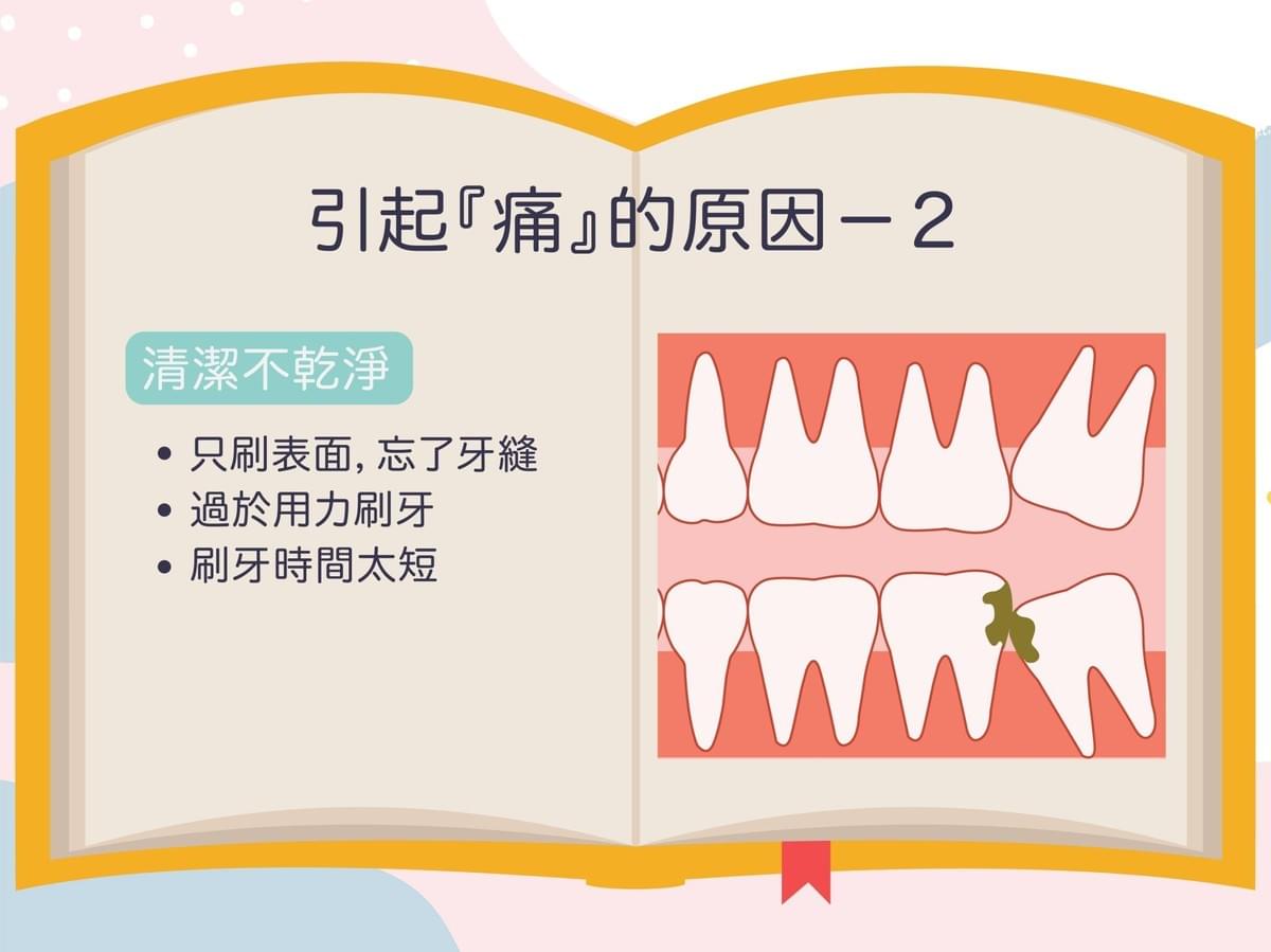 為什麼長智齒會痛?因為清潔不乾淨,刷牙時間太短,沒有仔細清潔牙縫 為什麼長智齒會痛?因為清潔不乾淨,刷牙時間太短,沒有仔細清潔牙縫