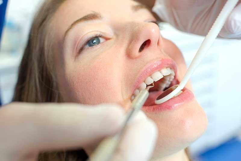 composite resin fillings composite resin fillings