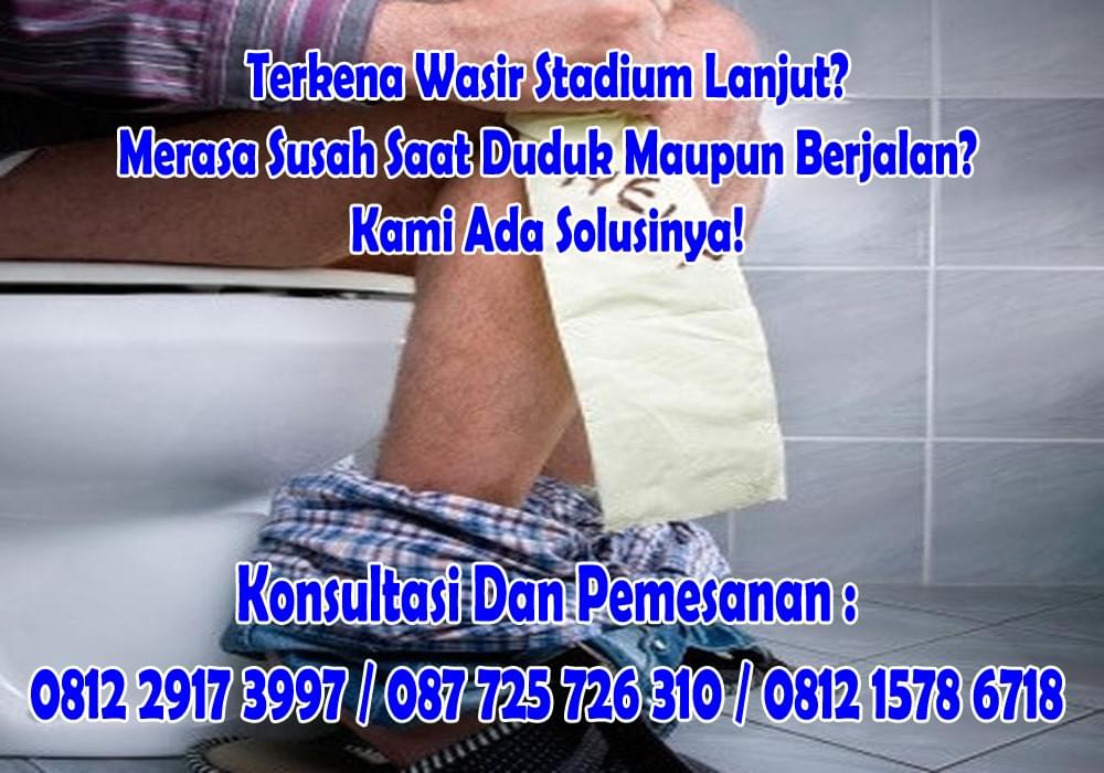 Distributor Tablet Obat Ambeien Hemoroid Yang Aman Untuk Ibu Hamil Serta Manjur Ambeyen Parah Ambeyen Berdarah Wasir Ambeien Obat Wasir Ambejoss Wasir