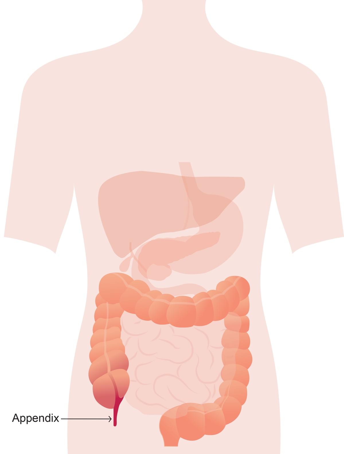Professionals With Appendix Treatment in Surat Professionals With Appendix Treatment in Surat