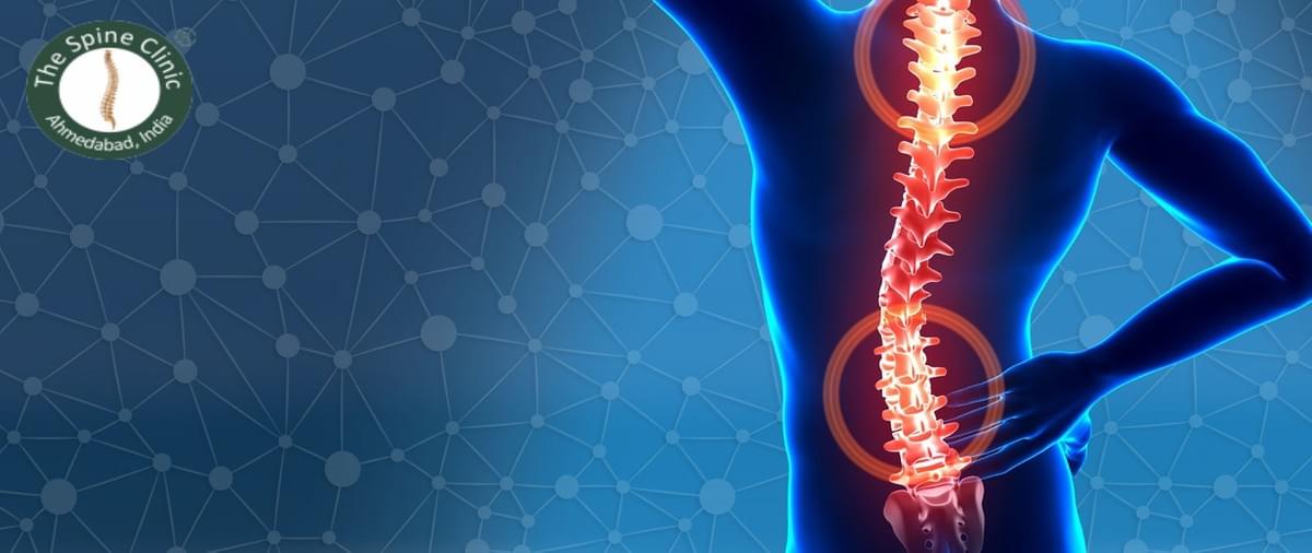 best spine doctor in Ahmedabad best spine doctor in Ahmedabad