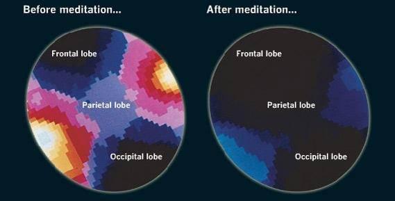 effets de la méditation sur le cerveau effets de la méditation sur le cerveau