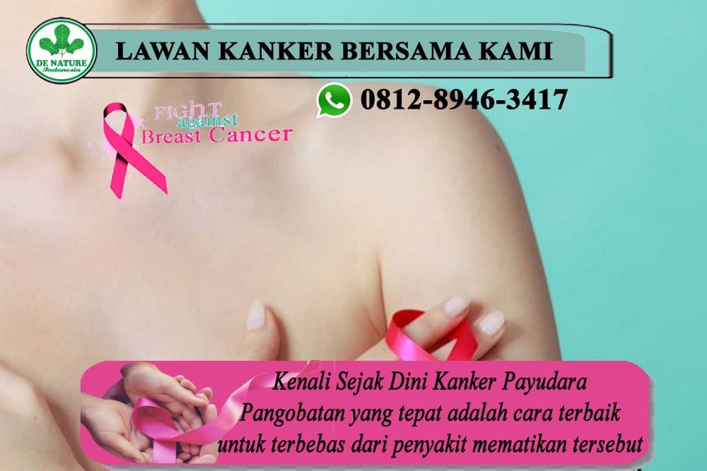 Tanaman Obat Herbal Alami Untuk Sakit Kanker Payudara Sebelah Kanan Dan Kiri Obat Kanker Payudara