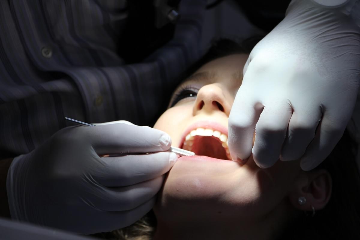 Wisdom Teeth Melbourne Wisdom Teeth Melbourne