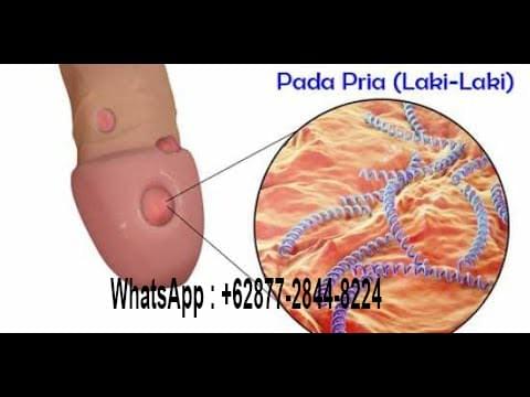 Cara Mudah Mengobati Buang Air Kecil Penis Terasa Sakit Tanpa