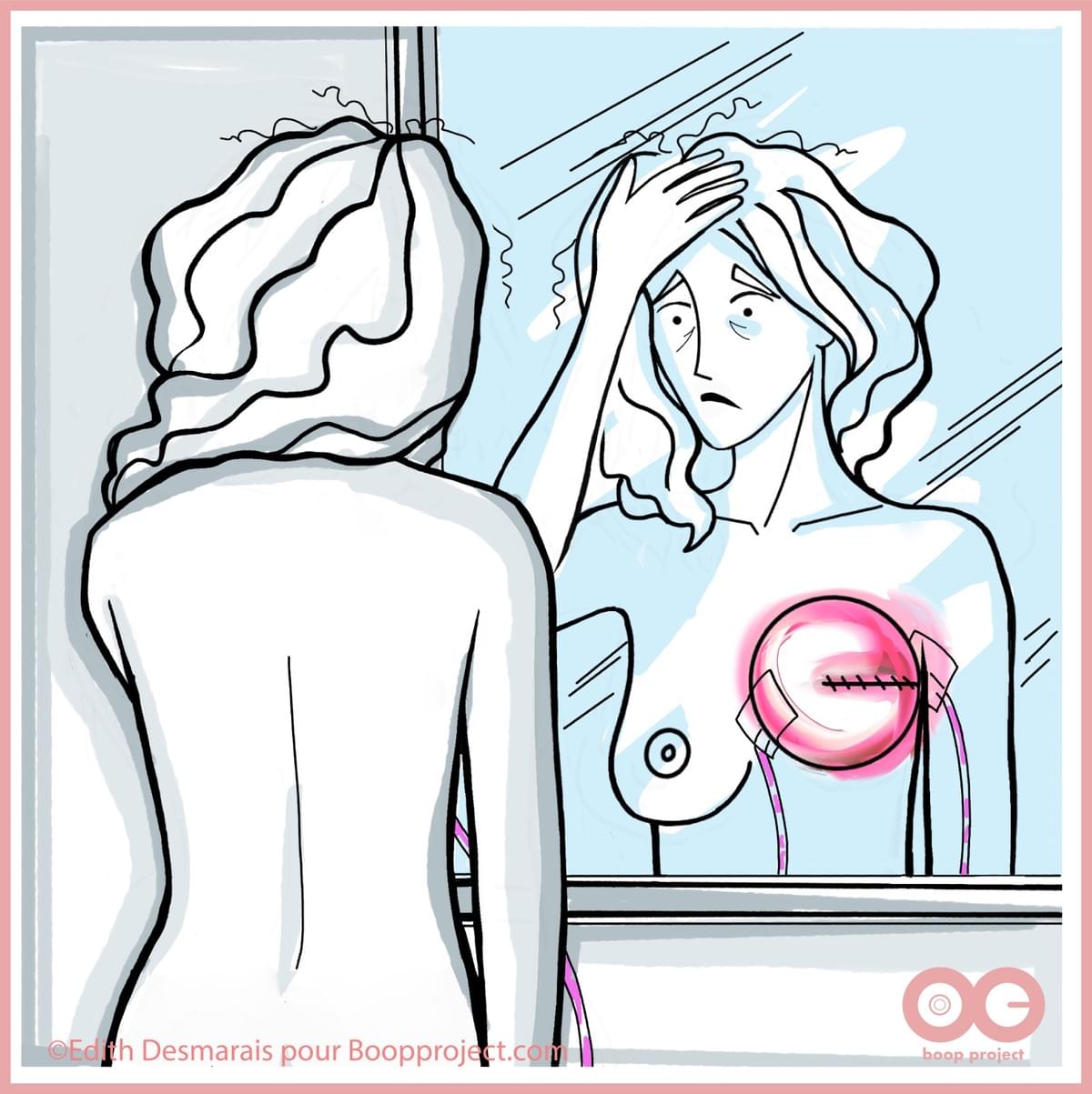 Cancer du sein: Illustration Edith Desmarais pour Boop project Cancer du sein: Illustration Edith Desmarais pour Boop project