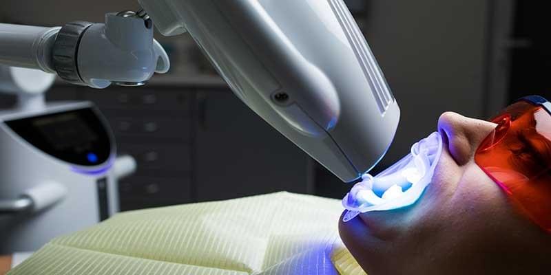 Teeth Whitening Treatments: Are they really safe? Teeth Whitening Treatments: Are they really safe?